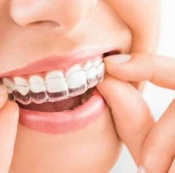 Aligner in Nagpur